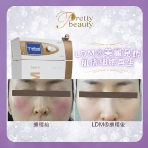 Read more about the article LDM®美麗見證 肌膚細胞再生