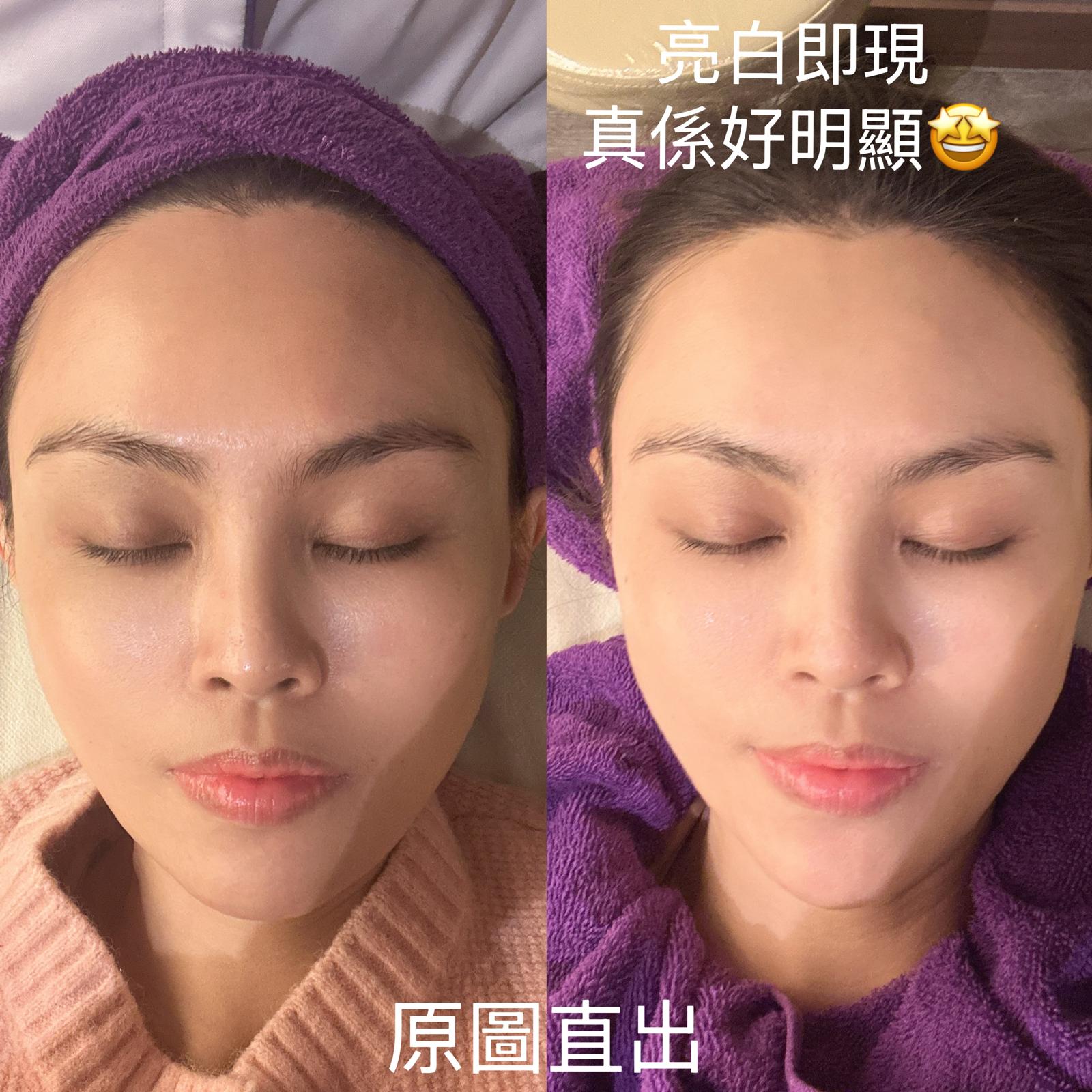 You are currently viewing LDM® 水滴提升療程｜Pretty Beauty 凱詩美容｜@Misscc.beauty